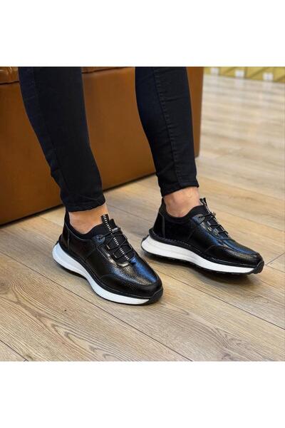 Parlak Streçli Günlük Ortopedik Ayakkabı