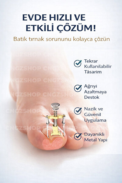 CNGZSHOP Batık Tırnak Düzeltme Aparatı | Ayak Tırnak Düzeltici Tel Sistemli P...