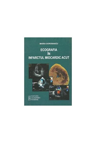 Editura Academiei Romane Ecografia in infarctul miocardic acut, Maria Dorob
