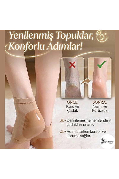 Eşya Dünyası Topuk Bakım Çorabı - Çatlak Giderici Nemlendirici ve Koruyucu Ay...