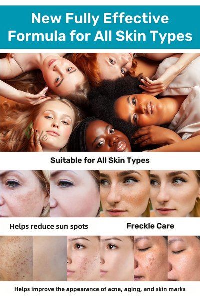 İlla Life Face & Skin Whitening Anti-Darkness Skin Whitening Cream Whitening Fast-Acting 50ml