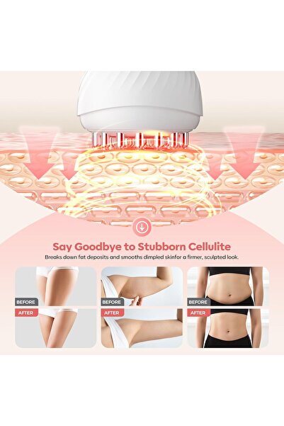 Sisso HarrFlow Lymphatic Drainage Massager & Anti Cellulite Massage Tool