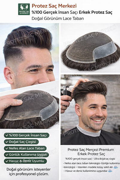 Protez Saç Merkezi French Lace %100 İnsan Saçı Naturel Şakak Bölgesi