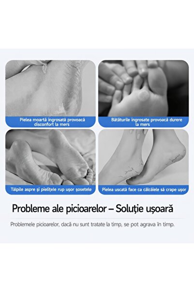 Foot Pilă electrică reîncărcabilă pentru picioare, capete din oțel inoxidabil