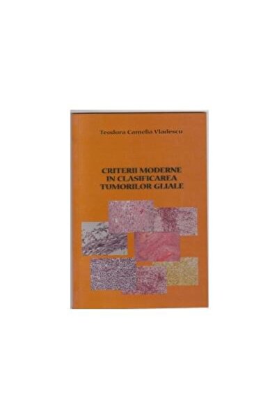 Editura Etna Modern criteria in the classification of glial tumors,