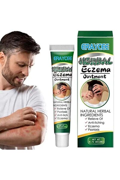 herbalimo Herbal Eczema Ointment, Medical Ointment for Dermatitis, Antibacter...