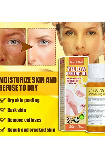 Arabest Yellow Peeling Oil,Strong Exfoliating Hyaluronate Treatment Oil for D...