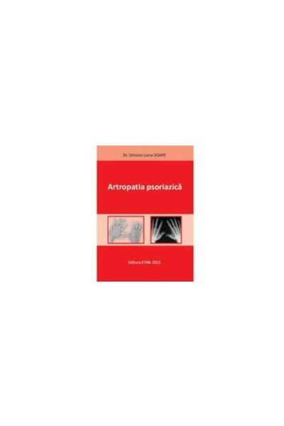Editura Etna Artropatia psoriazica, Dr. Simona Liana SOARE