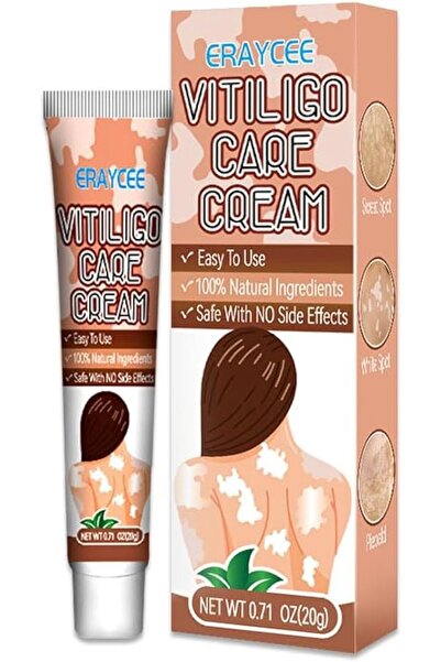 Yelajoy 2-Pack Skin Pigmentation Corrector, Natural Care Cream for White Spot...