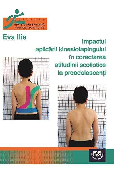 Editura Universitaria Impactul aplicarii kinesiotapingului in corectarea