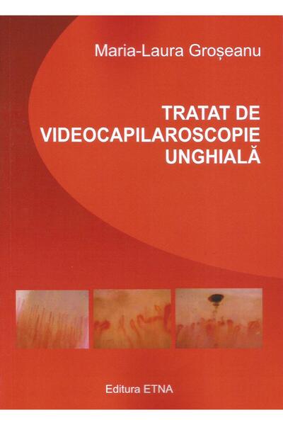 Editura Etna Nail videocapillaroscopy treatment, Maria-Laur