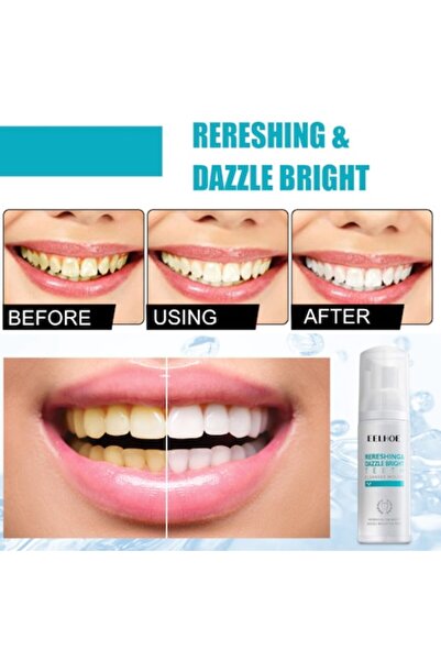 CRM Spumă pentru albire și detoxifiere dentară