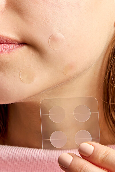 beije 24’lü Transparan Akne Bandı