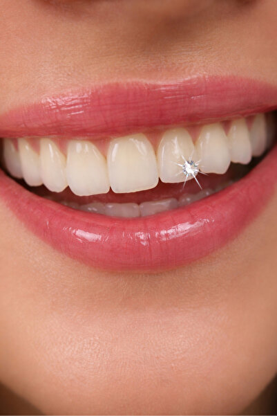 U&Gi Moda 5'li Diş Pırlantası, Diş Taşı Seti – Işıltılı Gülüşler