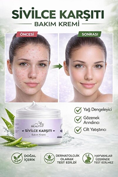 Miya Beauty Sivilciye Karşı Önleyici Krem Vitamin İçeren Siyah Nokta Ákne Sîv...