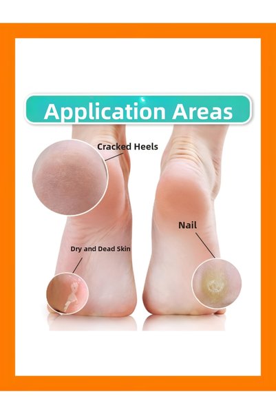 SheMask Foot Mask Peel-Off Peeling Mask Foot Care Mask Foot Care Socks Dead Skin Cleaner 2X Set