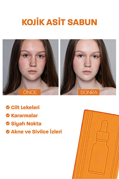Quality Life Doğal Kojik Asit Sabunu 5 Aktif Leke Kararma Karşıtı Beyazlatıcı Akne Yağ Sebum Dengeleme