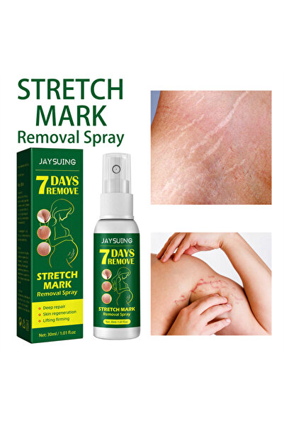 jaysuing Σπρέι 7 ΗΜΕΡΩΝ - Έντονη Θεραπεία για Ραγάδες, Γρήγορη Εξασθένιση, Βα...