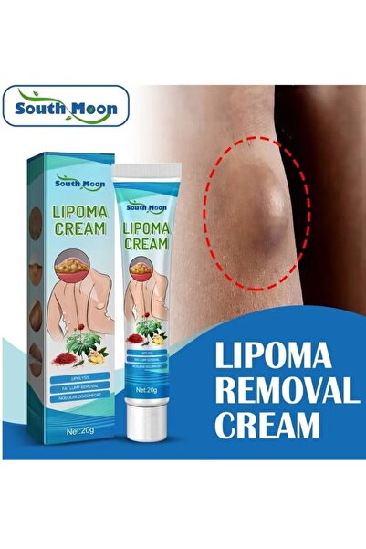South Moon Lipoma Removal Cream 20g