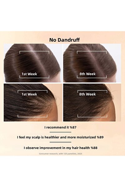 Pantene Grow Abundant Hair Loss Prevention Scalp Serum with Pro-V Complex + Niacinamide 60ml