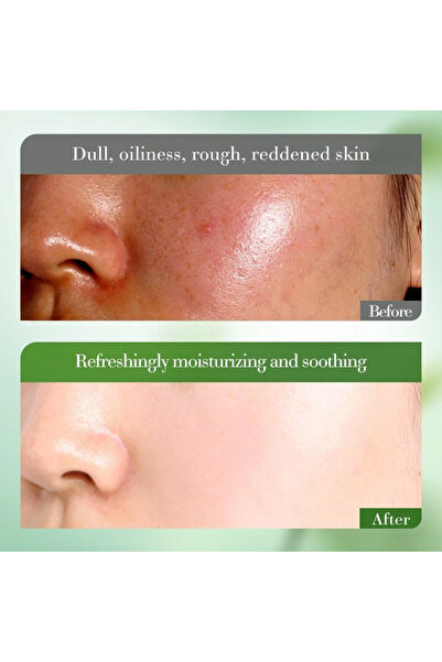 Bioaqua Aloe Vera Skincare 6 pcs Set suitable for all skin types