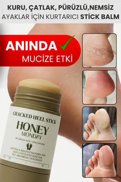 HONEY MONDAY Ayak ve Topuk Çatlak Bakımı | Ayak Kokusu , Sertleşmiş Pürüzlü T...
