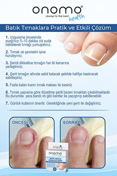 Onomo Health Batık Tırnak Düzeltici Şerit 10 Adet