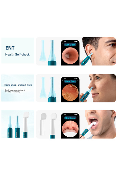 Bebird EarSight Ultra Smart Visual Earwax Removal Kit