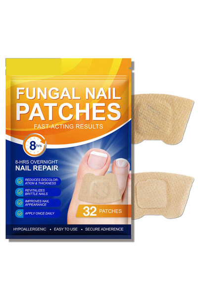 NOVA KISS Σετ 32 αντιμυκητιασικών επιθεμάτων για ταλαιπωρημένα νύχια, κατά τω...