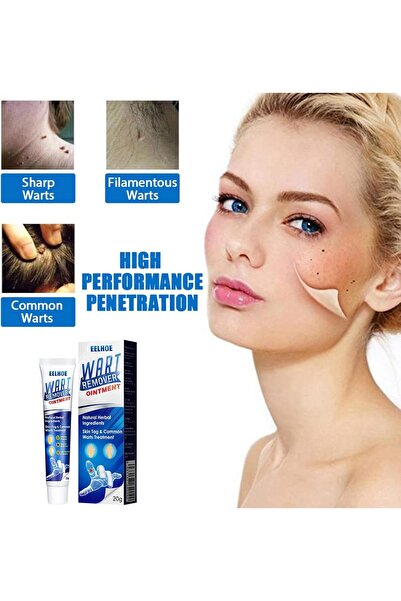 ZTJCY Wart Remover Gentle Skin Tag Remover Repair Ointment Fast Acting Natural Formula Safe Effective Wart