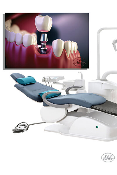 Single, Horizontal, Canvas, Decorative, Wall, Table , Oral and Dental Health, Dentist, Implant