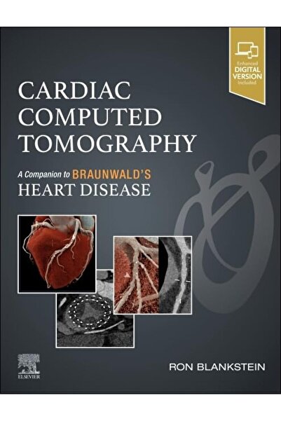 Elsevier Καρδιακή Υπολογιστική Τομογραφία: Ένα Συμπλήρωμα στον Braunwald's