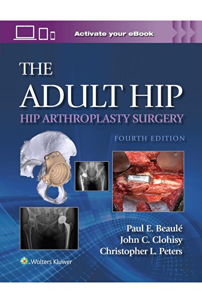 Wolters Kluwer Health Ενήλικος Ιόστης: Χειρουργική Αρθροπλαστική Ιόστης