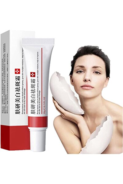 Yunnyp Whitening Freckle Cream, Remove Dark Spots Anti-Freckle Cream Niacinam...