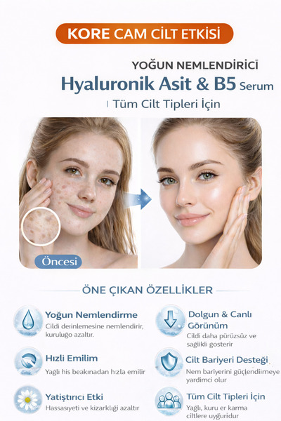 BEGISUN Kore Cilt Etkili Hyaluronik Asit & B5 Serum | & Yoğun Nem | Tüm Cilt ...