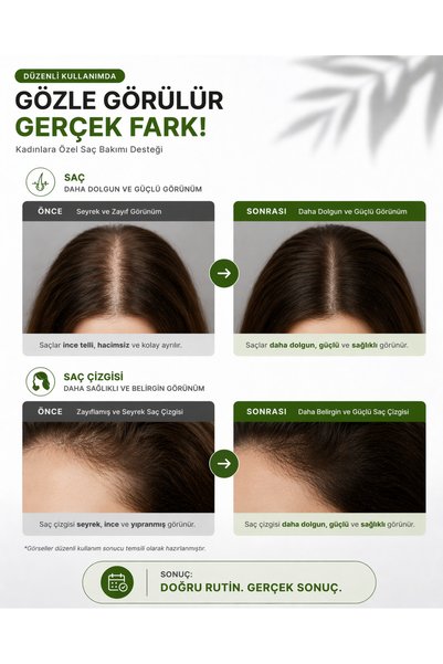 Dermotik Rosemary Water Set for Hair Formation, Nourishing and Anti-Shedding 100 ml