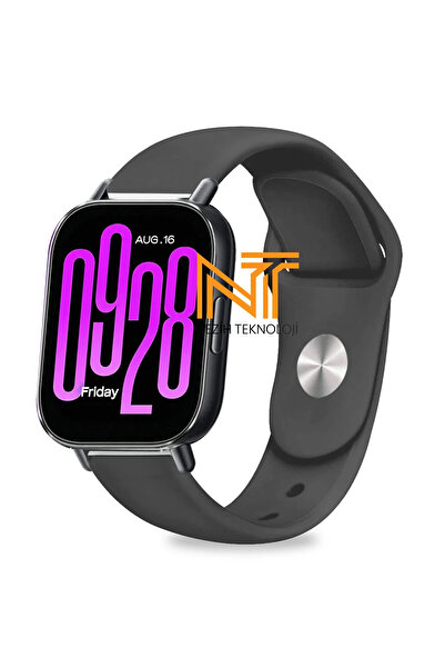 Nezih Case Redmi Watch 5 Active / Redmi 5 Lite Uyumlu A+ Kalite Yumuşak Silik...