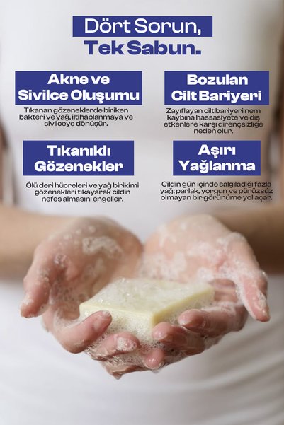 SOİTENN Oily Skin Facial Cleansing Soap for Oily and Acne-Prone Skin 75 Gr