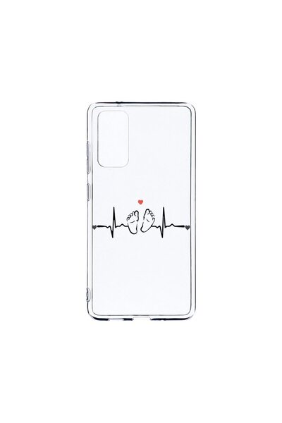 bestcase Husa BestCase¬Æ Διαφανής Σιλικόνη 2MM, Συμβατή με Samsung Galaxy S20...