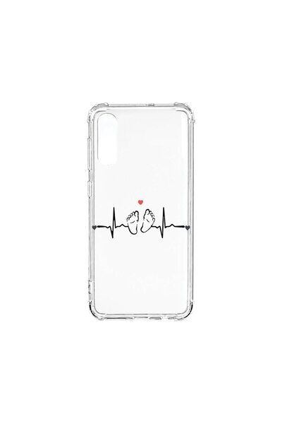 bestcase Αντικραδασμική Θήκη 1.5MM, Συμβατή με Samsung Galaxy A50, My Little ...