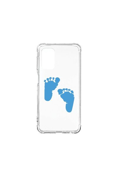 bestcase Αντικραδασμική Θήκη 1.5MM, Συμβατή με Samsung Galaxy S20, Σχέδιο Ποδ...