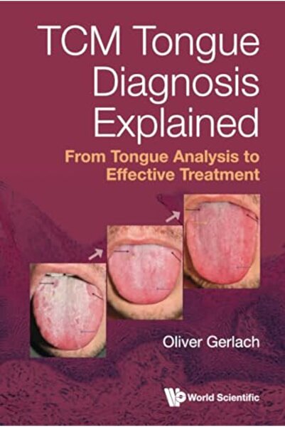 Ingram Tcm Tongue Diagnosis Explained: From Tongue Analysis To Effective Trea...