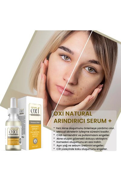 Oxi Natural Anti-Acne & Purifying Serum+ 30 Ml.