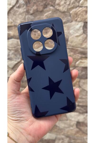 Vip Case Redmi Note 14 Pro 4G Uyumlu Star Silikon Darbe Emici Klasik Korumalı...