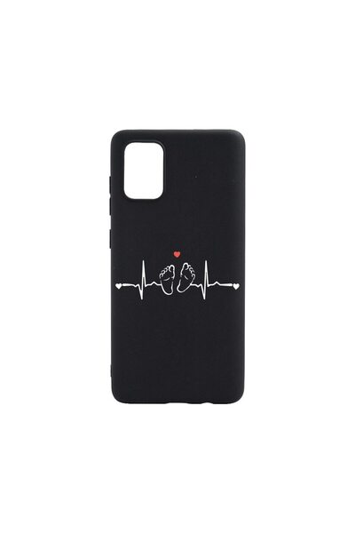 bestcase Λεπτή Θήκη Σιλικόνης 0.8MM, Συμβατή με Samsung Galaxy S20, My Little...