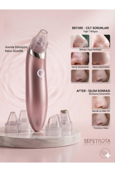 sepetrota Clear-Pore | 4 Başlıklı ve 5 Kademeli Şarjlı Vakumlu Siyah Nokta Te...