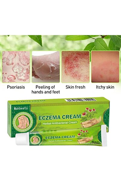 Makbeaty Herbal Cream, Antibacterial Cream for Body Itching