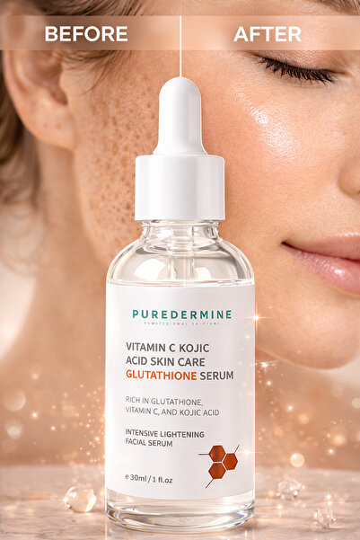 Puredermine Kojic Acid & Vitamin C Serum |   Anti-Blemish, Skin Brightening, ...
