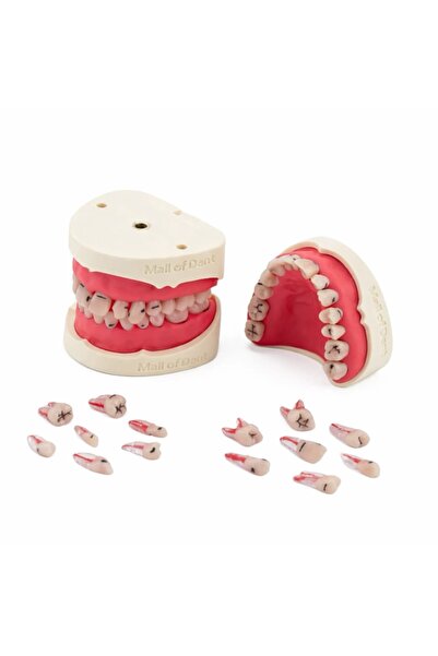 mallofdent 28 Dişli Fantom Endodontik Tam Çene (Kronlu Çürüklü) - Diş Hekimli...