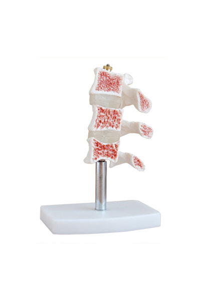 EgeAnatomi Maketleri Bel Omurga Kemik Maket Osteoporoz Anatomik Modeli 16x12x...